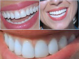 DİŞ HEKİMİ HATİCE DÖĞER (0533)2528932 İSTANBUL